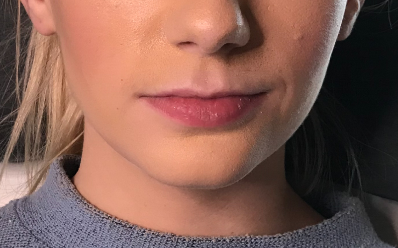 Before treatment