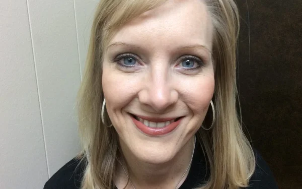 Cheeks After treatment