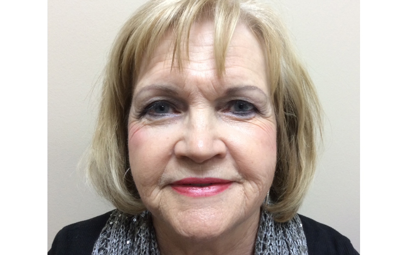 Lower Face Before treatment