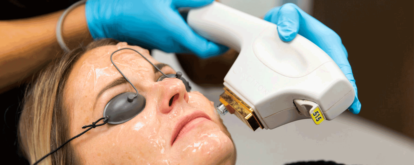 BBL Hero treatment at Marina Lifestyle Medicine