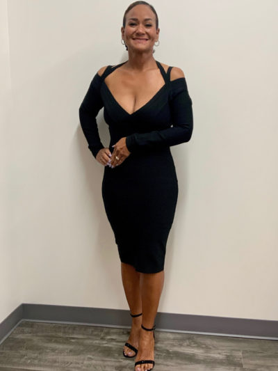 Susan After Semaglutide Weight Loss